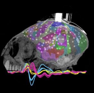 Signal curves over a 3D brain model illustration