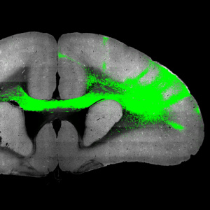 Tracer fluorescent signal showing on a microscopy brain slice
