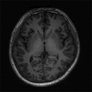 Human MRI image illustration